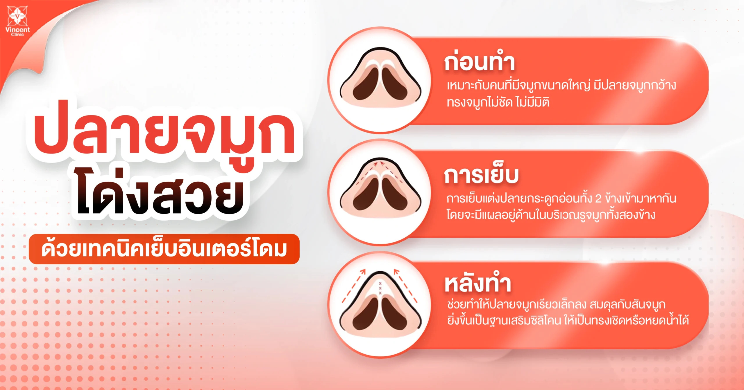 ปลายจมูกโด่งสวยด้วยเทคนิคเย็บอินเตอร์โดม