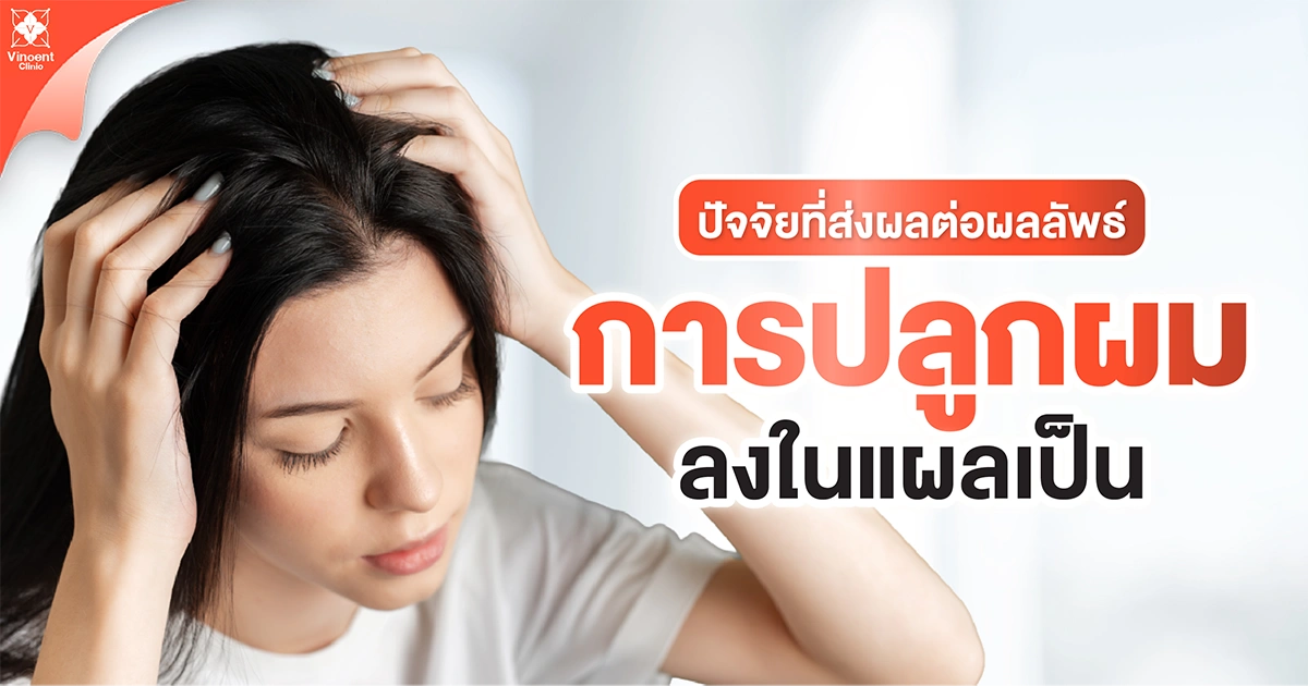 ปัจจัยที่ส่งผลต่อการปลูกผมลงในแผลเป็น