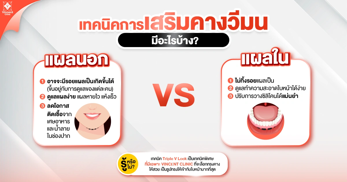 เทคนิคเสริมคางวีมนมีอะไรบ้าง