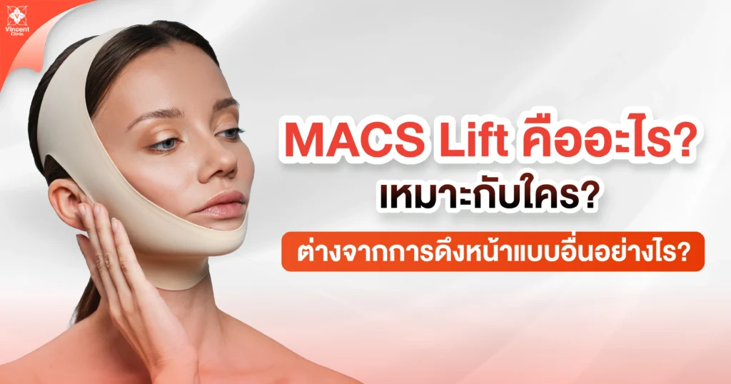 macs lift คืออะไร