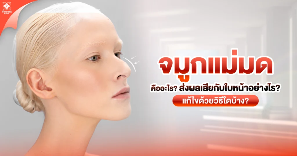 จมูกแม่มดคืออะไร