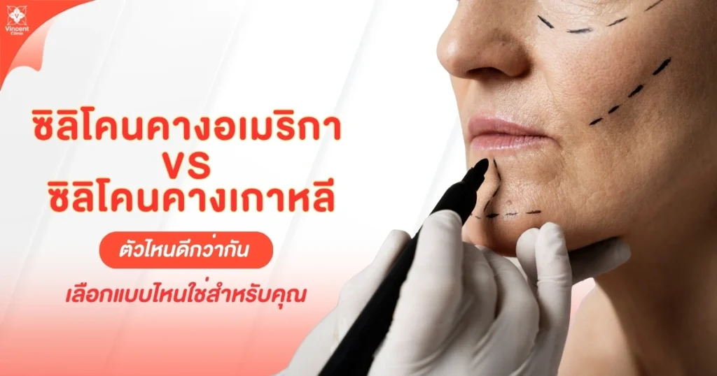 ซิลิโคนคางเมริกา และซิลิโคนคางเกาหลี ตัวไหนดีกว่ากัน