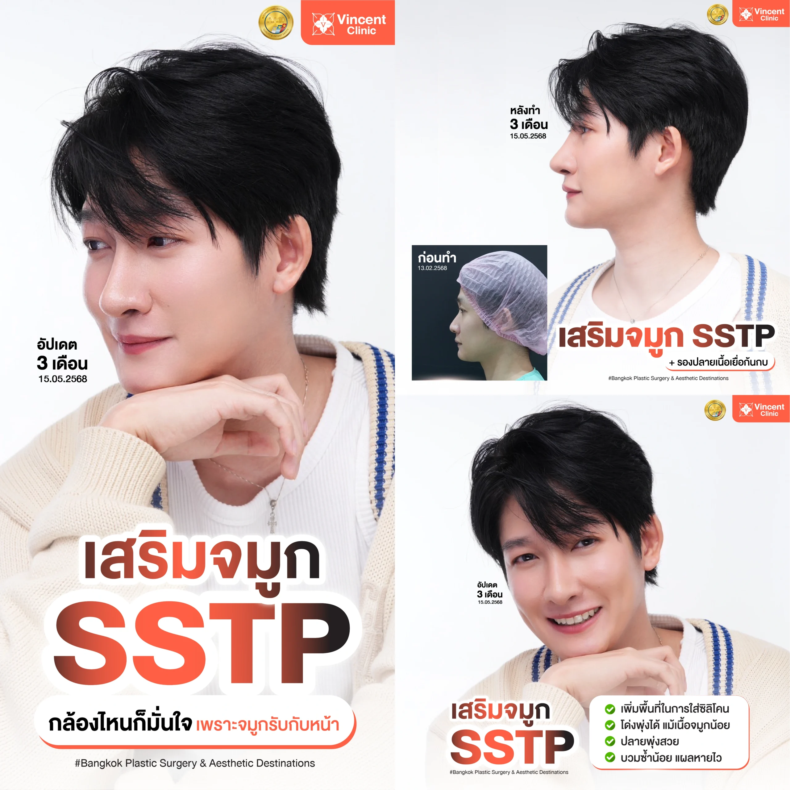 เสริมจมูกที่ Vincent Clinic