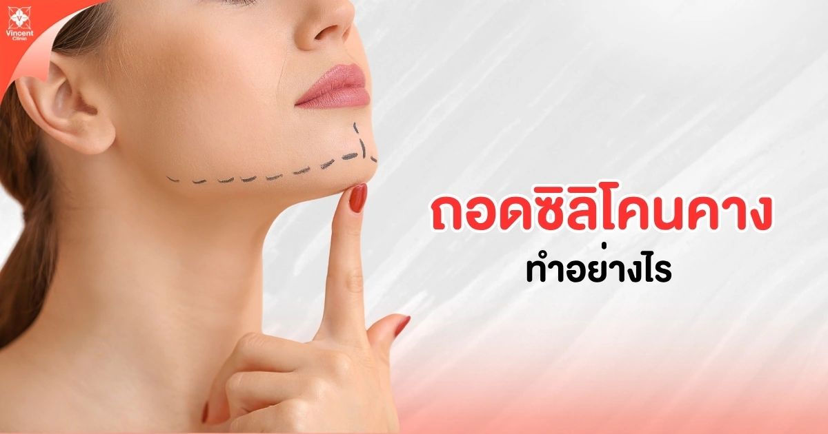 ถอดซิลิโคนคางทำอย่างไร