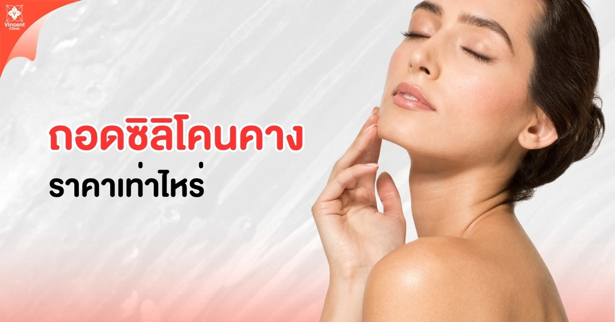 ถอดซิลิโคนคางราคาเท่าไหร่