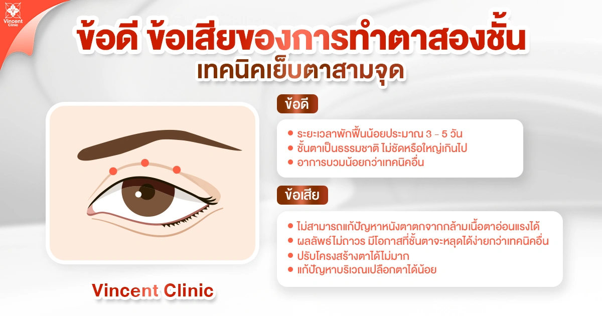 ข้อดีข้อเสียทำตาสองชั้นเทคนิคเย็บตามสามจุด