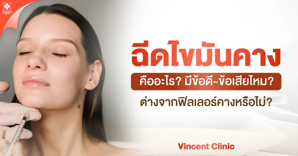 ฉีดไขมันคางคืออะไร