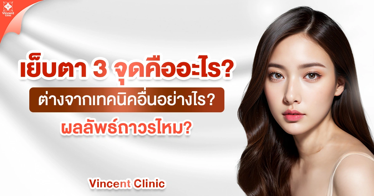 เย็บตาสามจุดคืออะไร