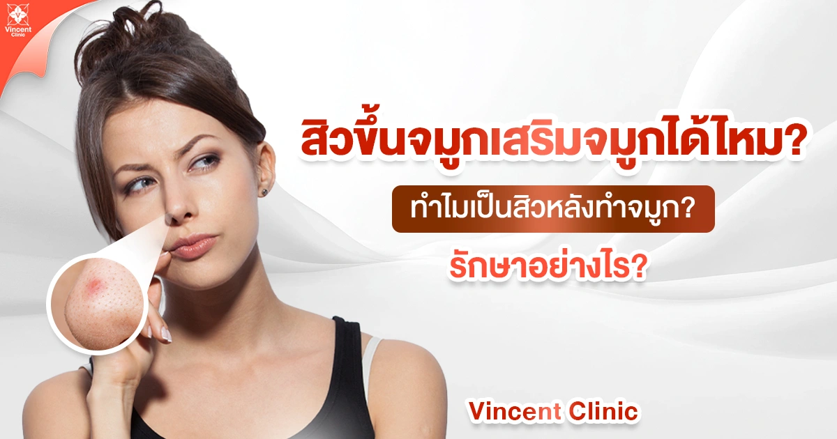 สิวขึ้นจมูกเสริมจมูกได้ไหม ทำไมเป็นสิวหลังทำจมูก รักษาอย่างไร?