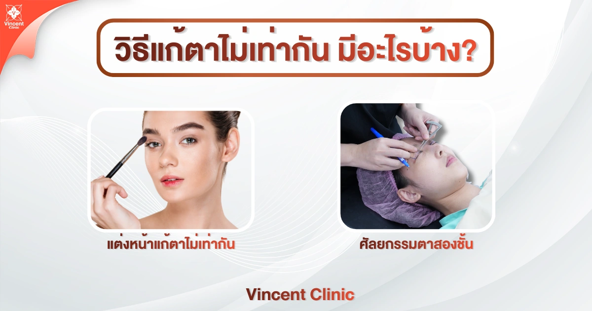 วิธีแก้ตาไม่เท่ากัน มีอะไรบ้าง