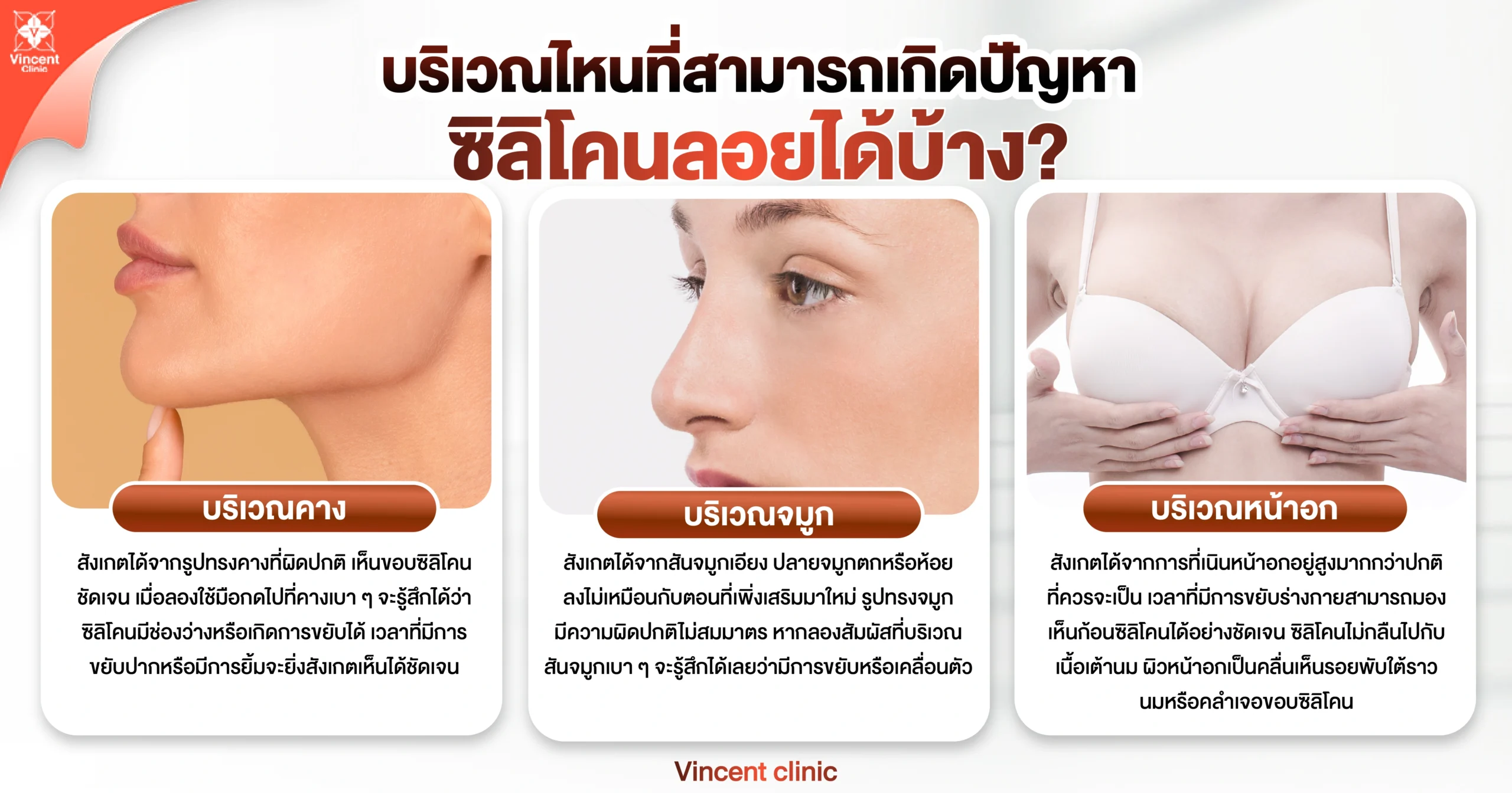 บริเวณไหนที่สามารถเกิดปัญหาซิลิโคนลอยได้บ้าง