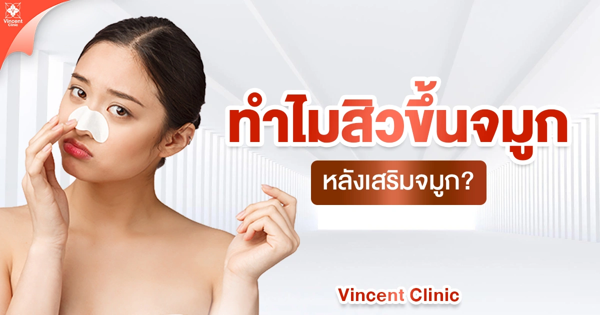  ทำไมสิวขึ้นจมูกหลังเสริมจมูก?