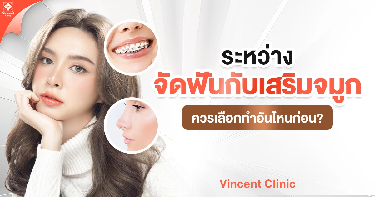 ระหว่างจัดฟันกับเสริมจมูกควรเลือกทำอันไหนก่อน