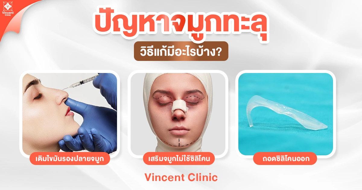 ปัญหาจมูกทะลุ วิธีแก้มีอะไรบ้าง