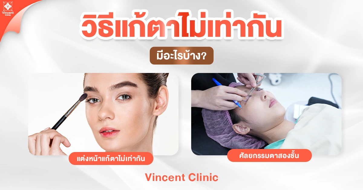 วิธีแก้ตาไม่เท่ากันมีอะไรบ้าง