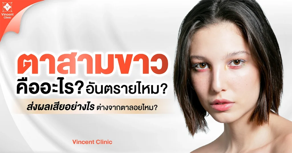 ตาสามขาวคืออะไร อันตรายไหม