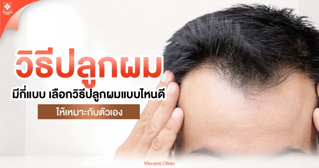 เลือกวิธีปลูกผมแบบไหนให้เหมาะกับตัวเอง