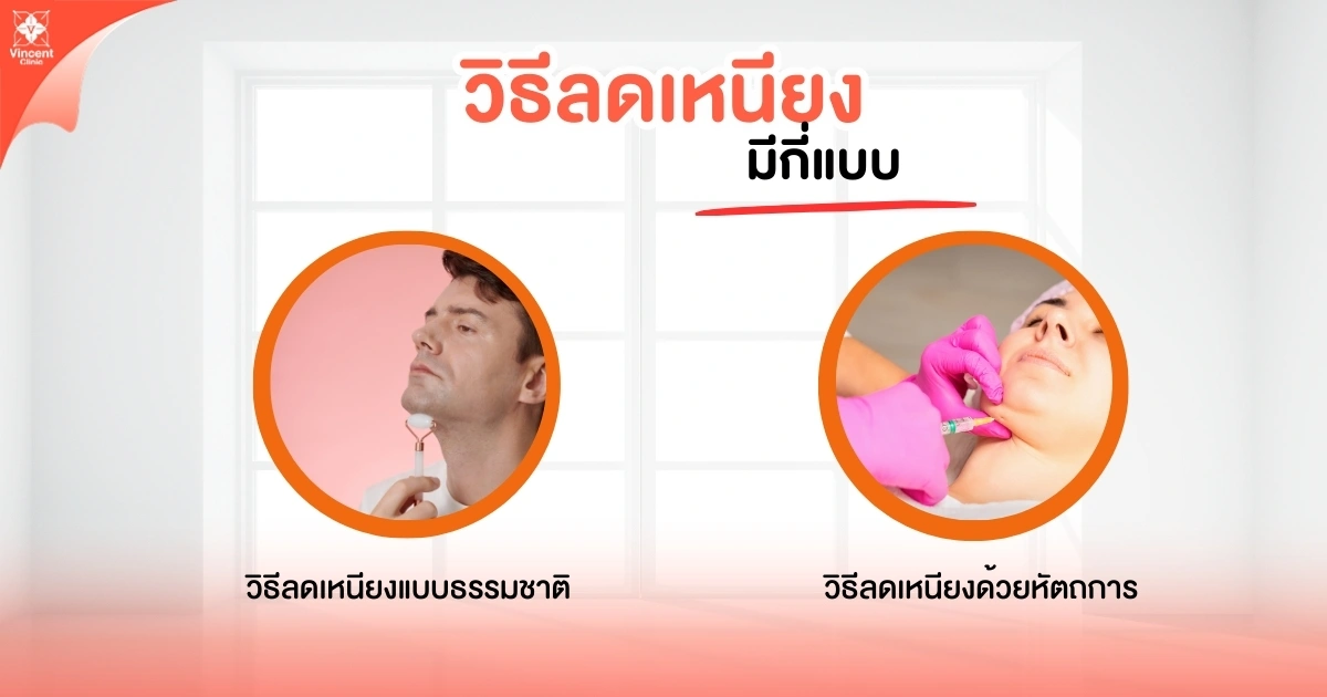 วิธีลดเหนียงมีกี่แบบ