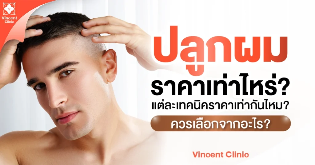 ปลูกผม ราคาเท่าไหร่ แต่ละเทคนิคราคาเท่ากันไหม ควรเลือกจากอะไร?