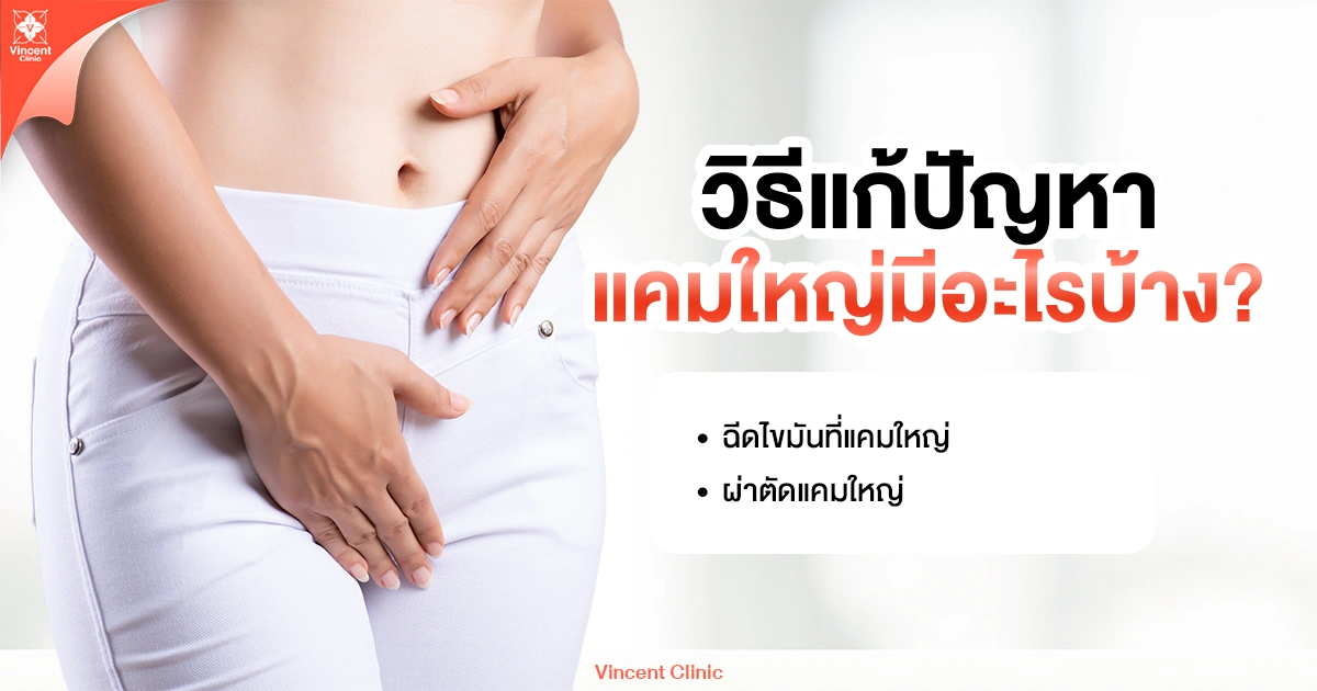 วิธีแก้ปัญหาแคมใหญ่มีอะไรบ้าง?