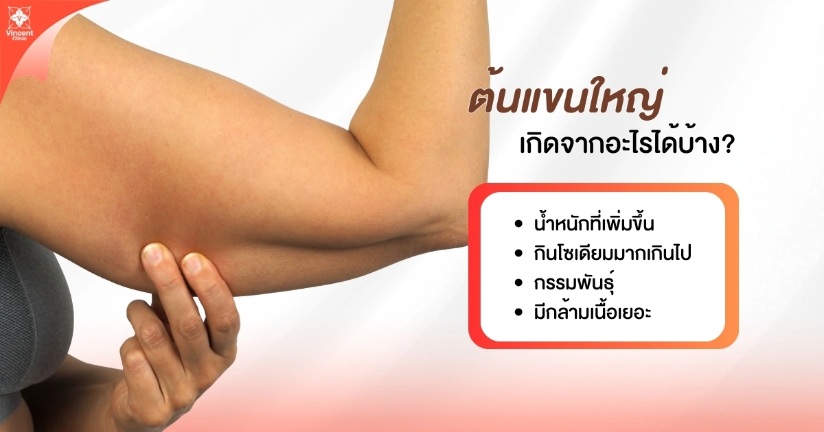 ต้นแขนใหญ่เกิดจากอะไรได้บ้าง