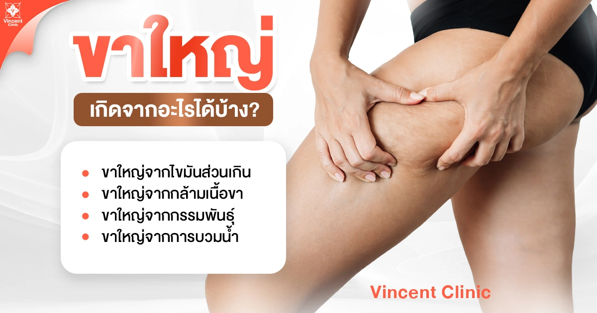 ขาใหญ่เกิดจากอะไร