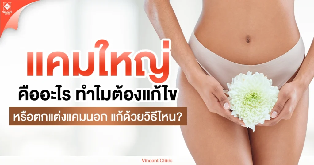 แคมใหญ่ คืออะไร ทำไมต้องแก้ไขหรือตกแต่งแคมนอก แก้ด้วยวิธีไหน?