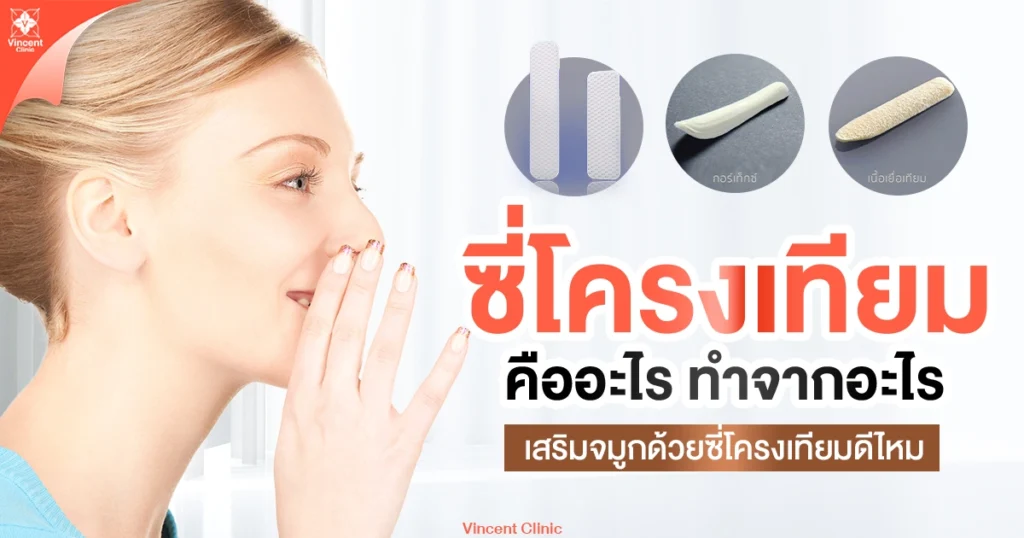 ซี่โครงเทียม คืออะไร