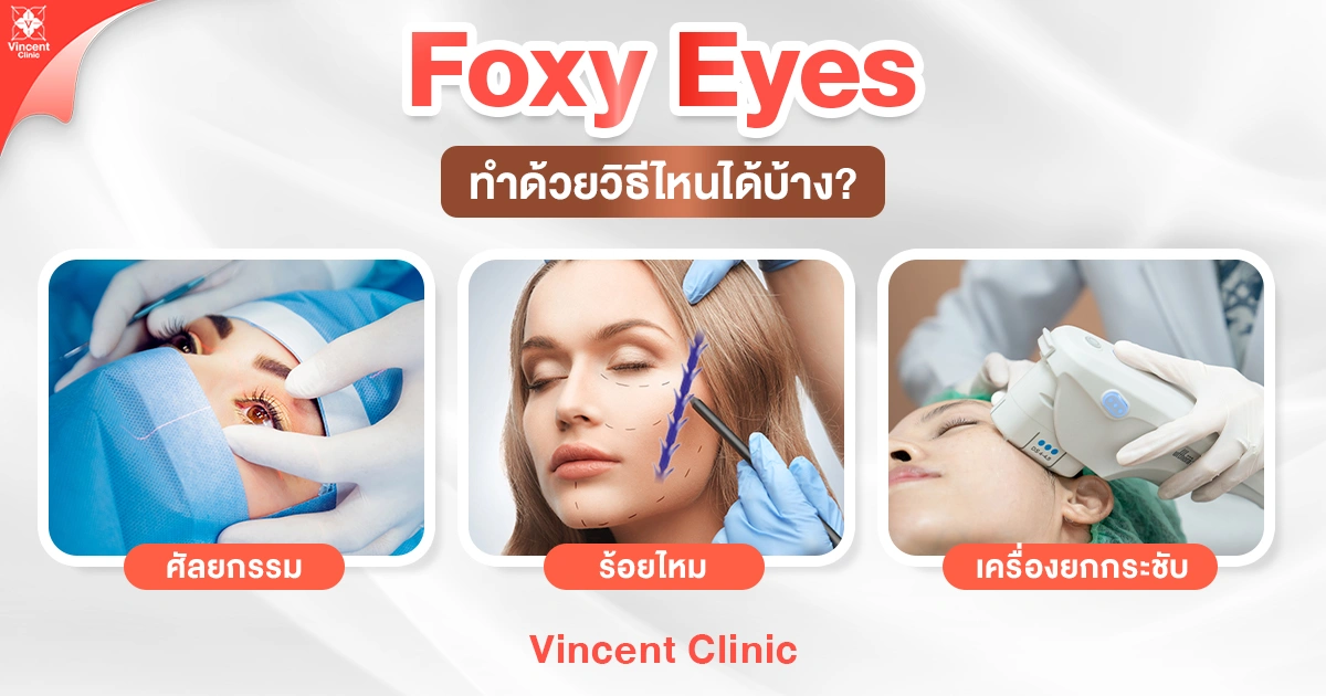 foxy eyes ทำด้วยวิธีไหนได้บ้าง