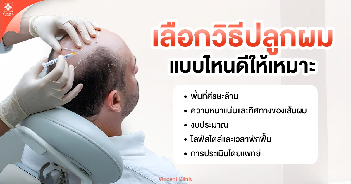 เลือกวิธีปลูกผมแบบไหนดีให้เหมาะ