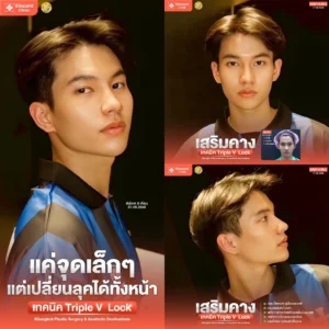 เสริมคาง คุณฮุย หมอแบงค์