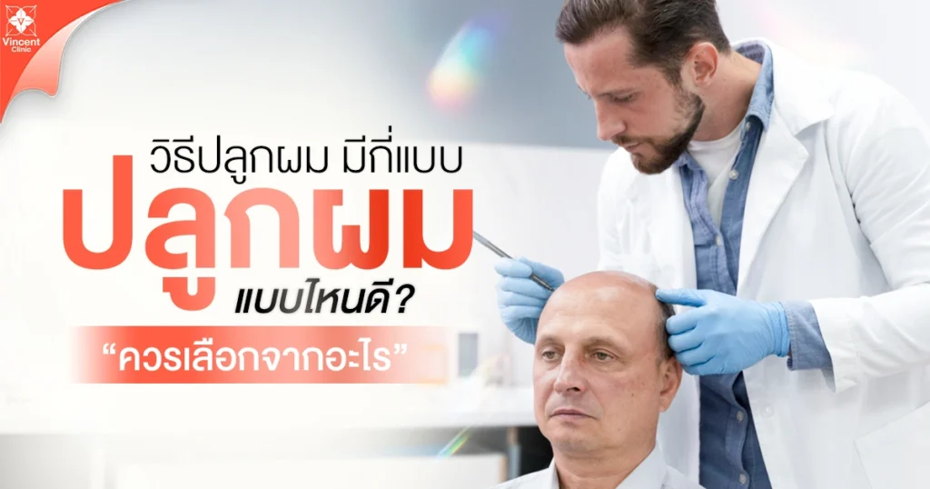 วิธีปลูกผมมีกี่แบบ