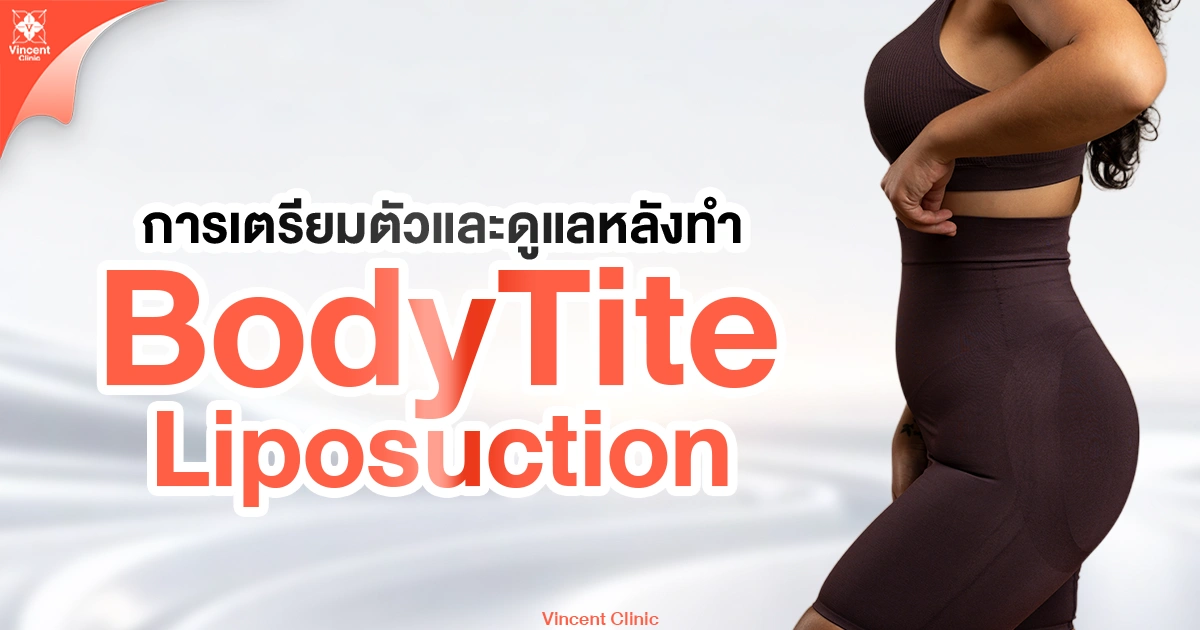การเตรียมตัวและดูแลหลังทำ body tite