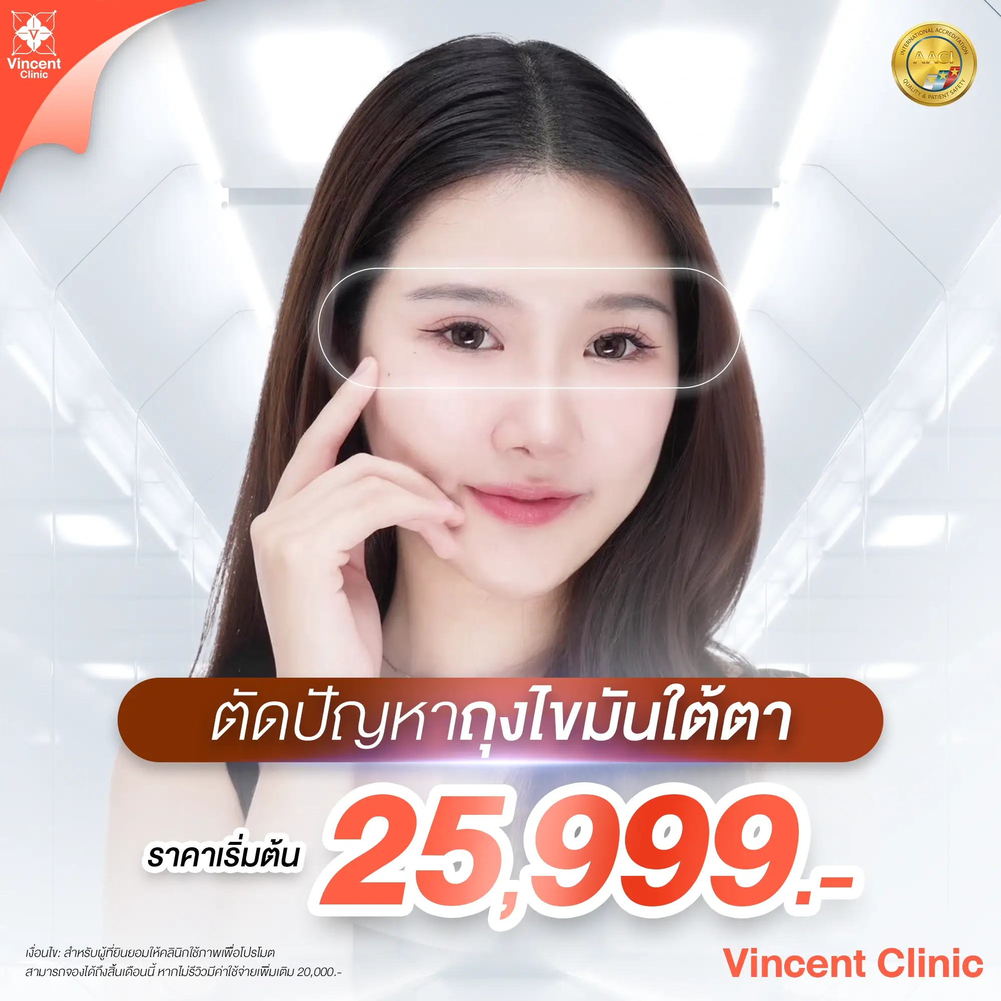 ราคาโปรโมชั่น ตัดถุงใต้ตา Vincent Clinic