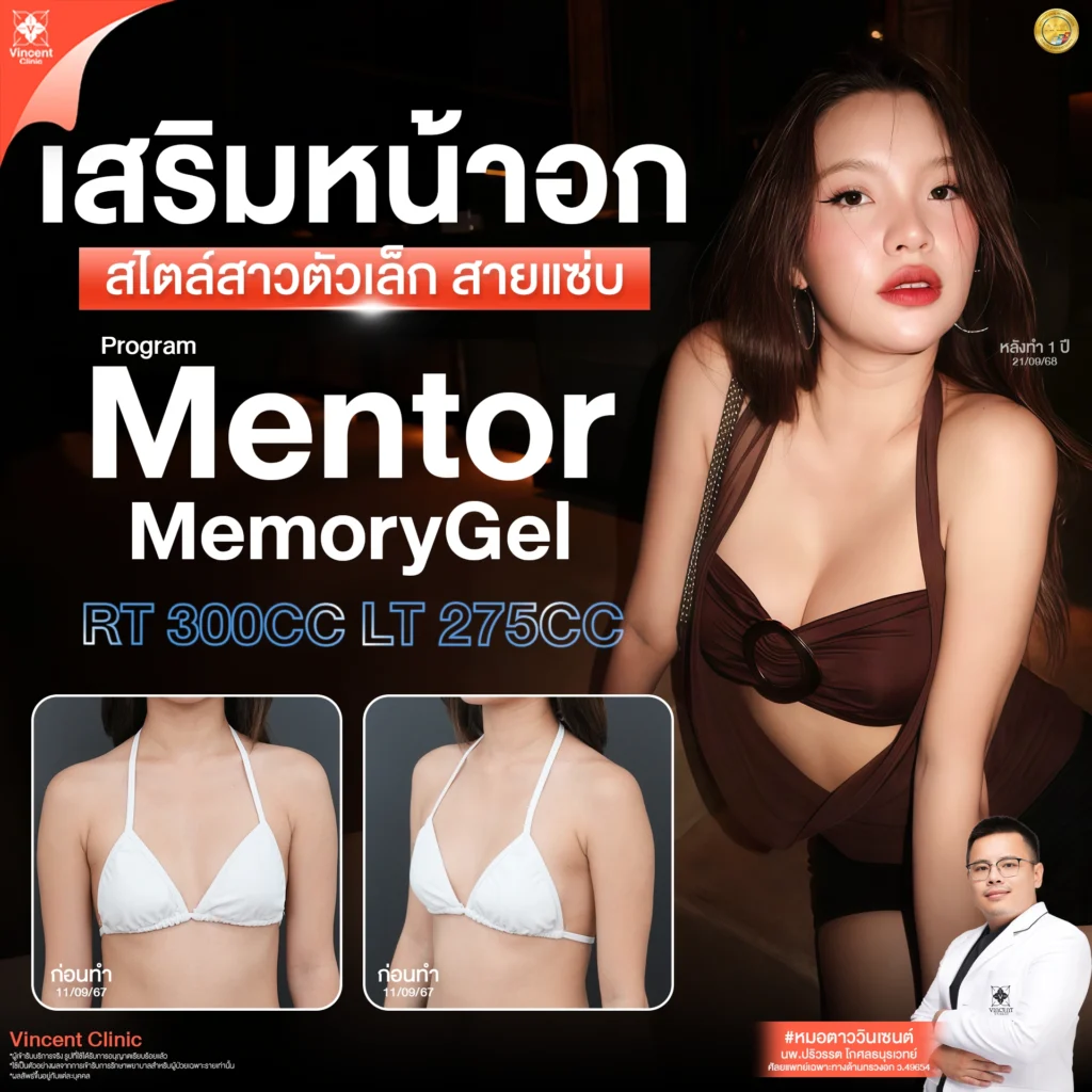 รีวิว เสริมหน้าอก Mentor memory gel 1 ปี คุณเอื้องฟ้า หมอตาว