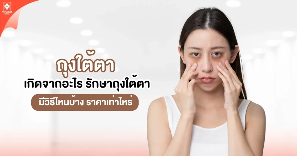 ถุงใต้ตาเกิดจากอะไร