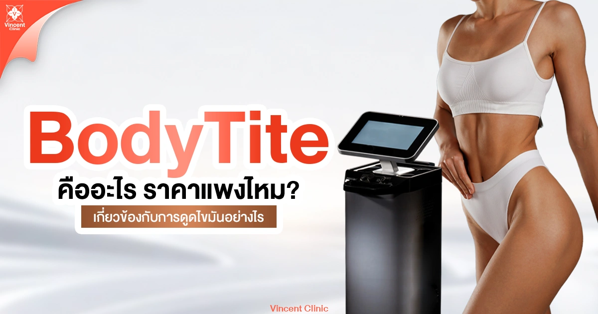 body tite คืออะไร ราคาแพงไหม
