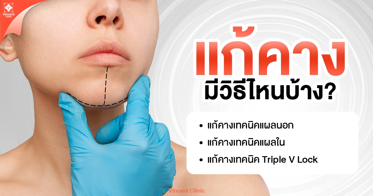 แก้คางมีวิธีไหนบ้าง