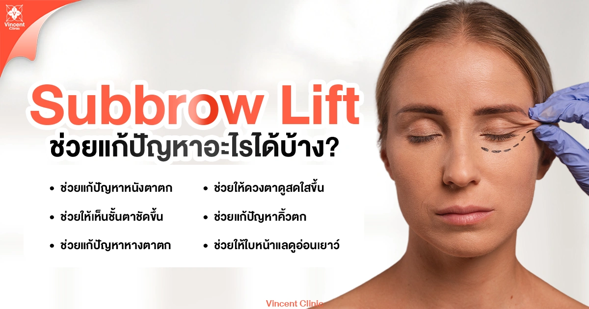 Subbrow lift ช่วยแก้ปัญหาอะไรได้บ้าง