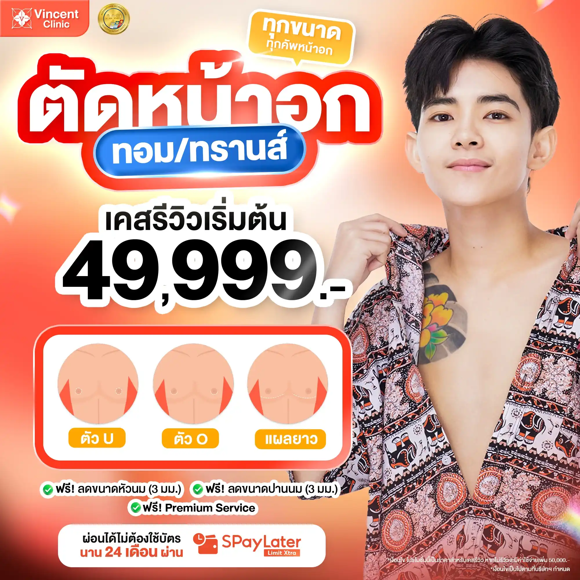 ตัดหน้าอก ราคา 49,999 บาท ตัดหน้าอกทอม ที่วินเซนต์คลินิก