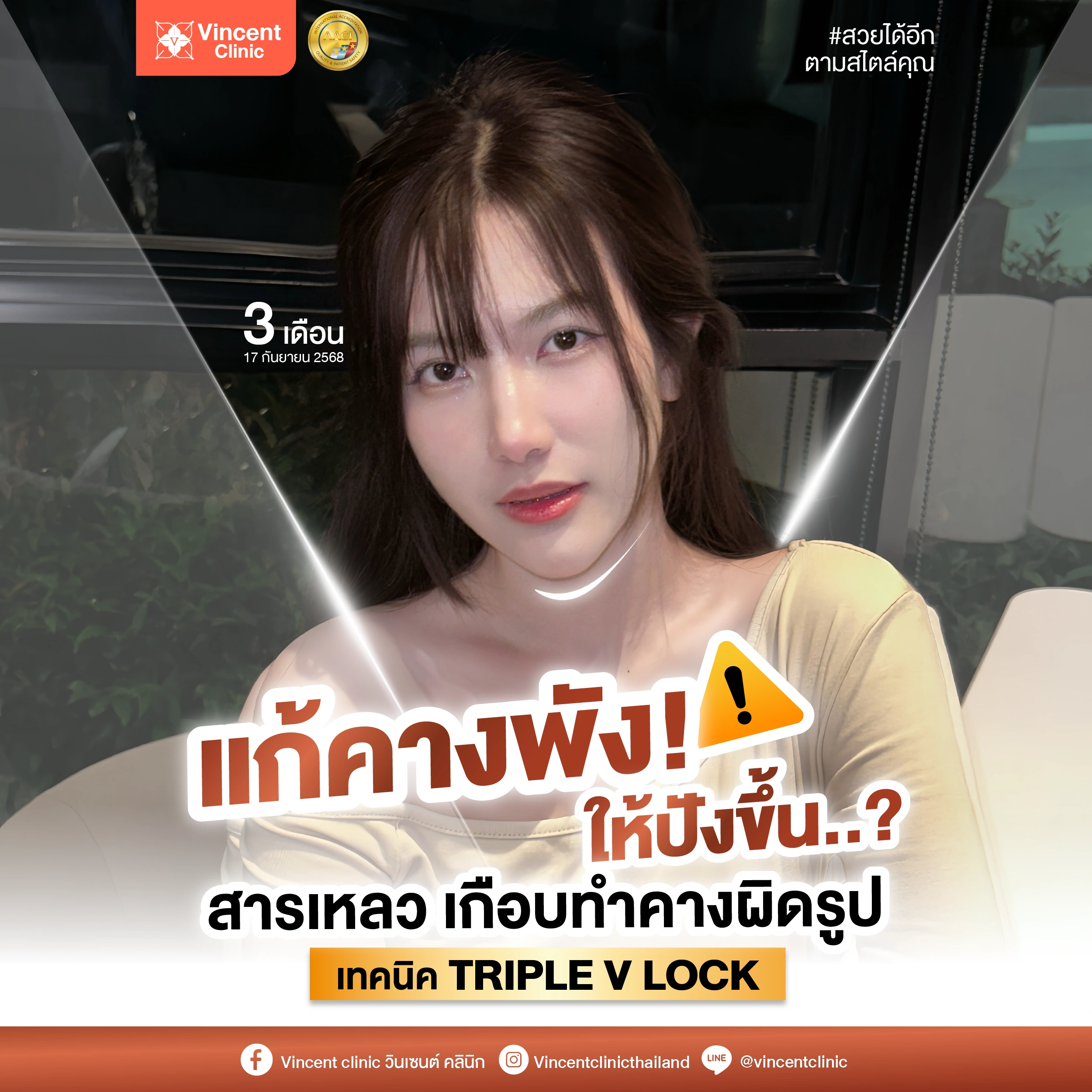 review chin surgery 2