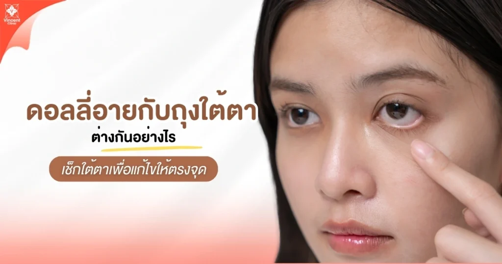 ดอลลี่อายกับถุงใต้ตาต่างกันอย่างไร