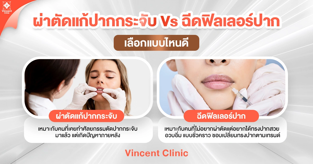 ผ่าตัดแก้ปากกระจับ Vs ฉีดฟิลเลอร์ปาด เลือกแบบไหนดี