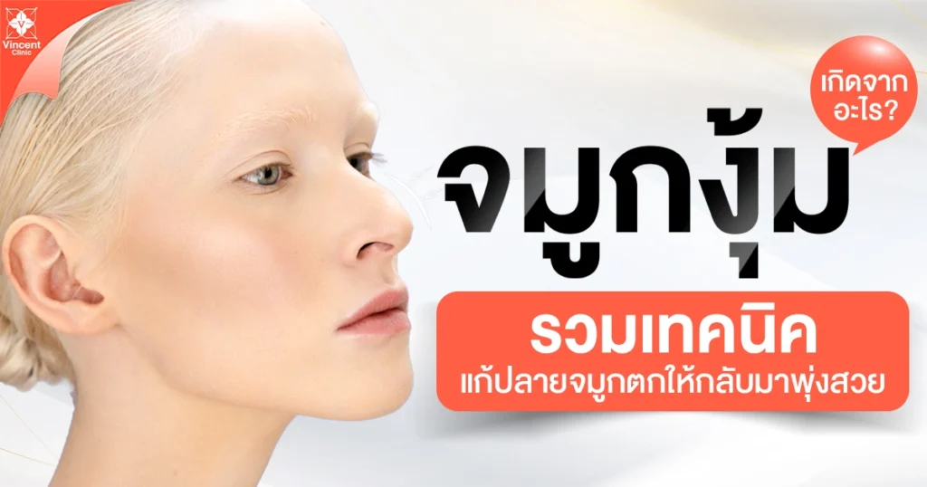 จมูกงุ้ม รวมเทคนิคแก้ปลายจมูกตกให้กลับมาพุ่งสวย