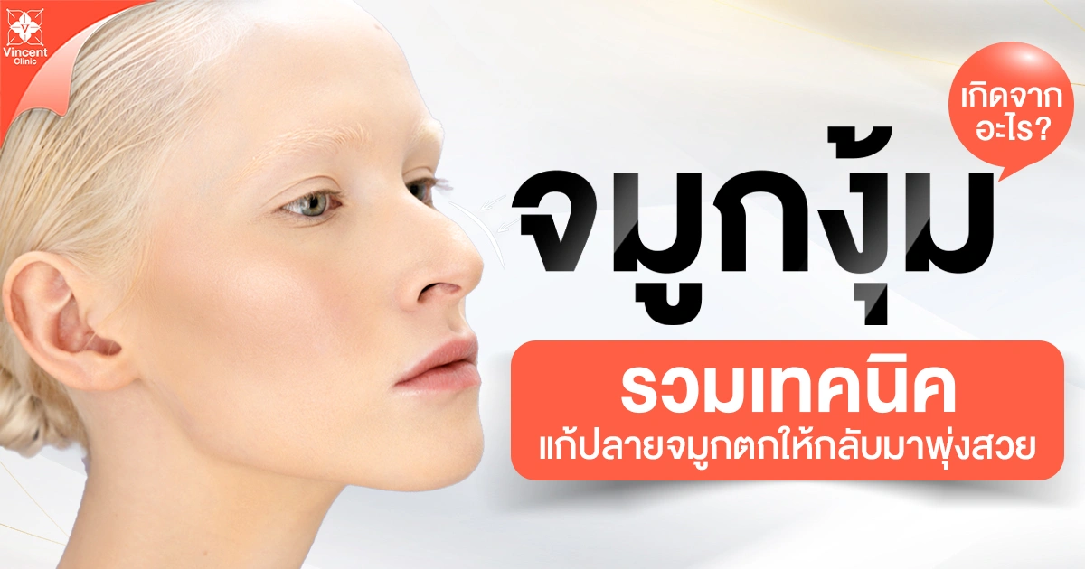 จมูกงุ้ม รวมเทคนิคแก้ปลายจมูกตกให้กลับมาพุ่งสวย