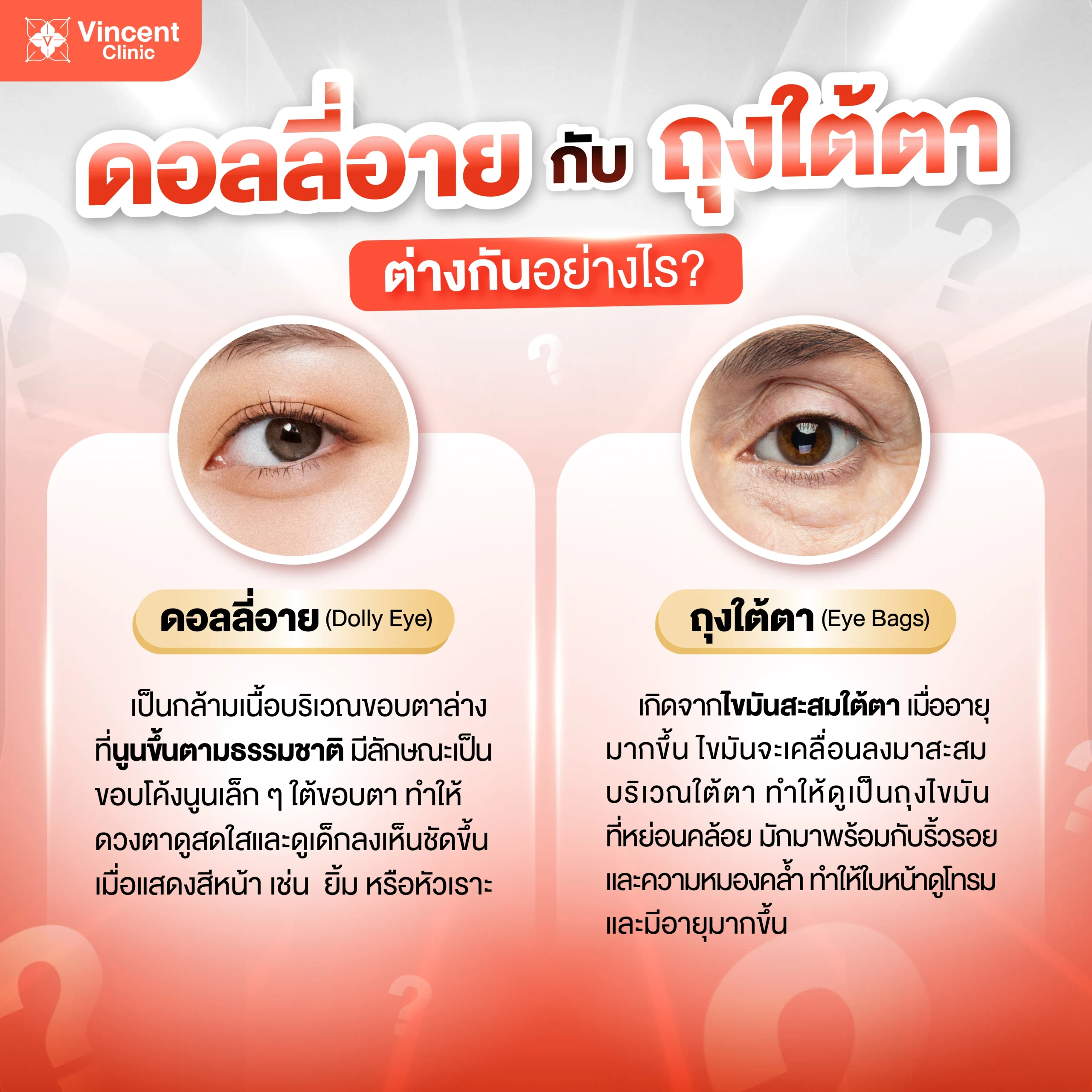 ดอลลี่อายกับถุงใต้ตา