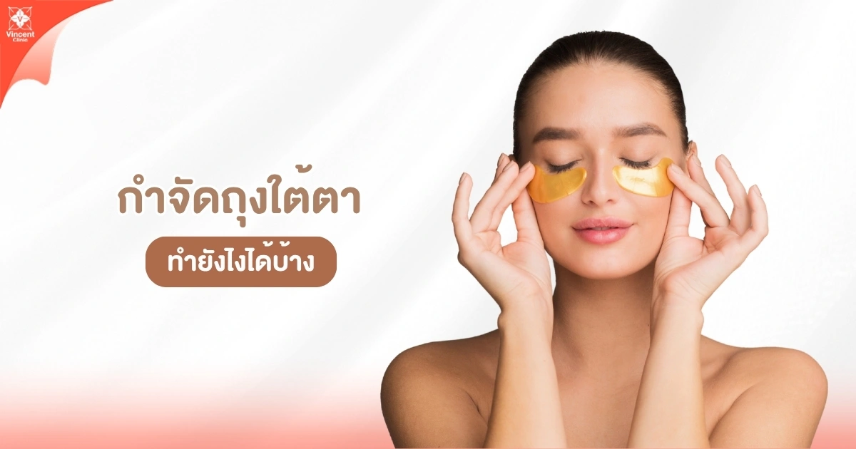 กำจัดถุงใต้ตา