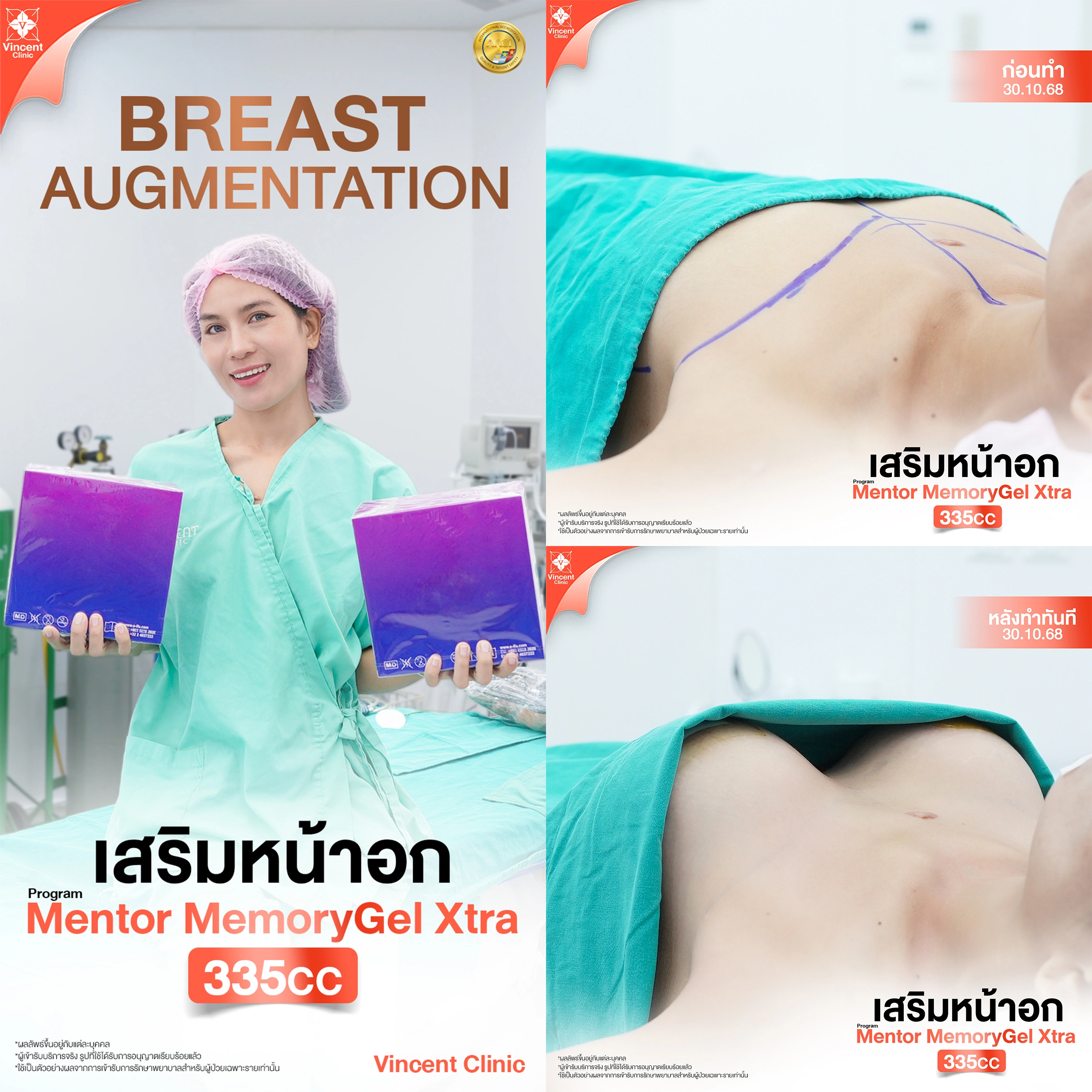 Mentor Memory Gel Extra รีวิว