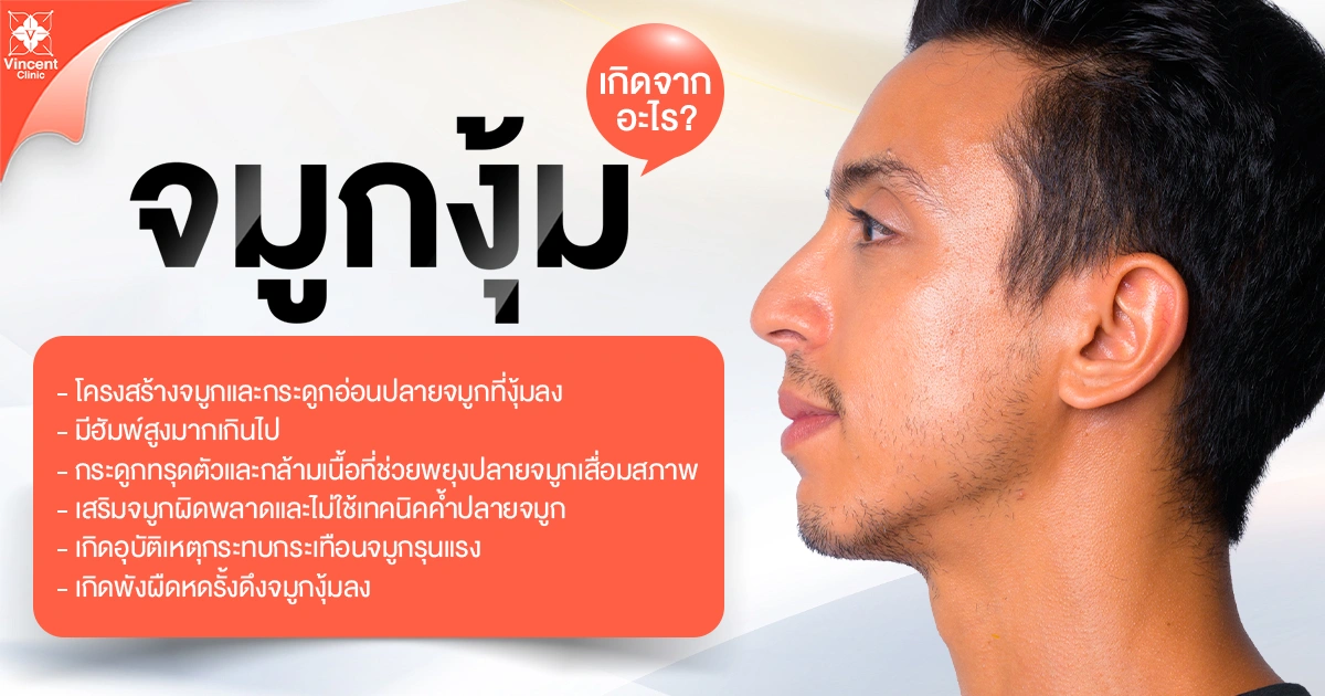 จมูกงุ้ม เกิดจากอะไร
