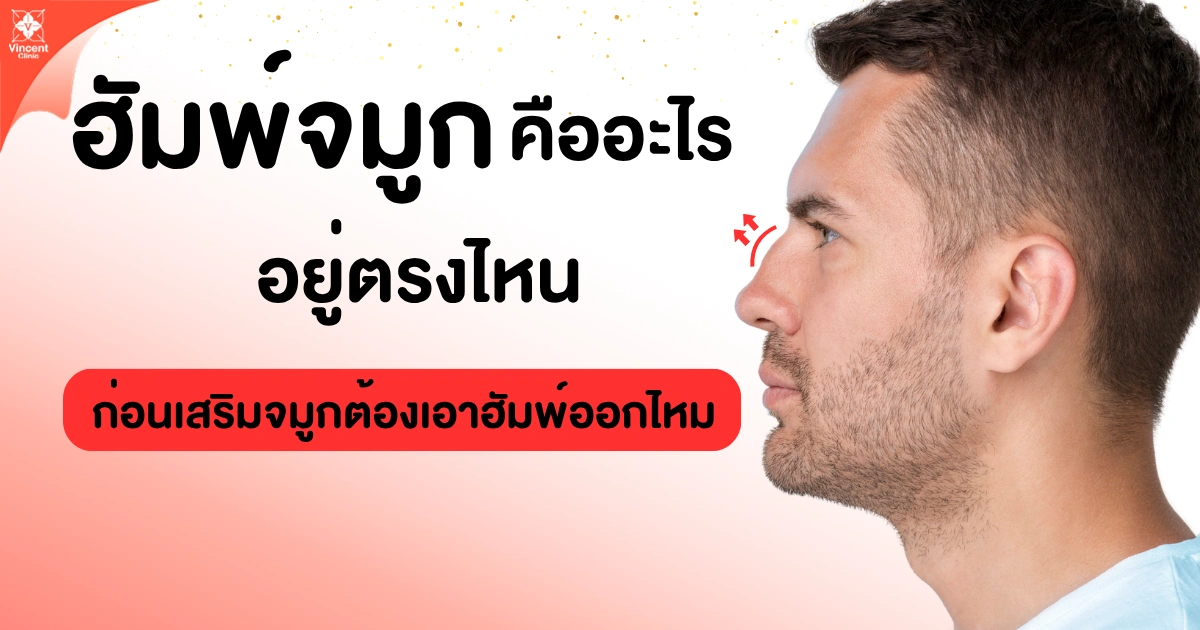 ฮัมพ์จมูกคืออะไร อยู่ตรงไหน
